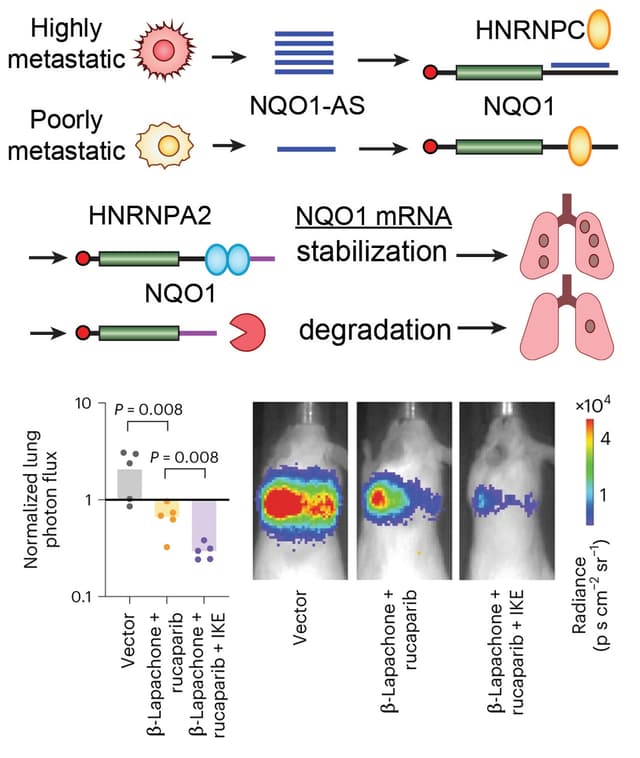 A sense-antisense RNA interaction promotes breast cancer metastasis via regulation of NQO1 expression